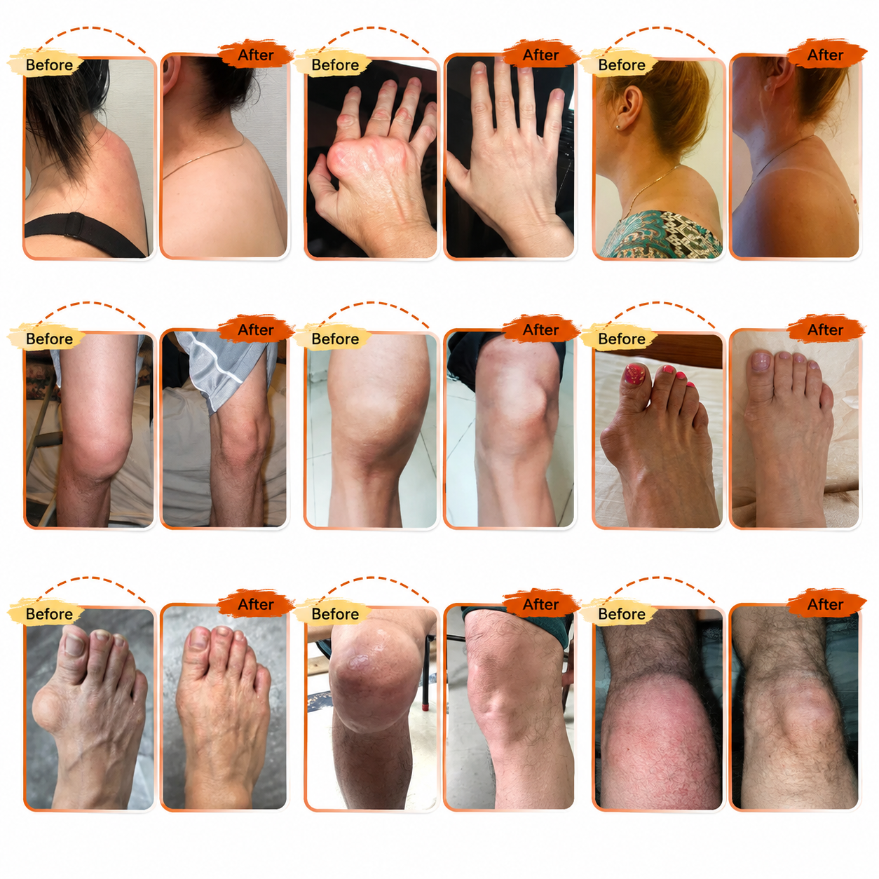 Turmeric & Emu Oil Arthritis Soothing Pain Relief Massage Gel